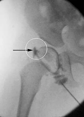 Anatomy Board Review 2005: High-Yield MCQs (Set 2) - Figure 14