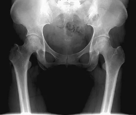Anatomy Board Review 2005: High-Yield MCQs (Set 2) - Figure 26