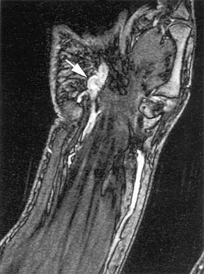 Anatomy Board Review 2005: High-Yield MCQs (Set 2) - Figure 27