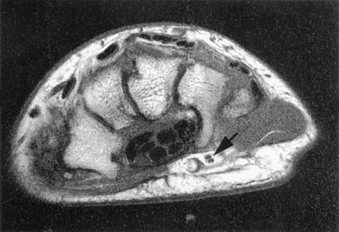 Anatomy Board Review 2005: High-Yield MCQs (Set 2) - Figure 6