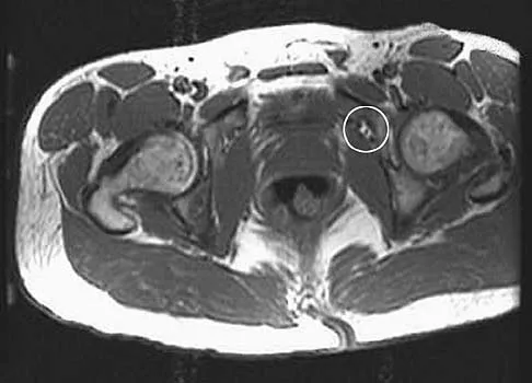 Anatomy 2005 Practice Questions: Set 3 (Solved) - Figure 17