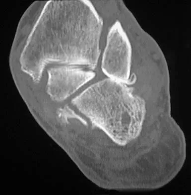 Anatomy 2005 Practice Questions: Set 3 (Solved) - Figure 21