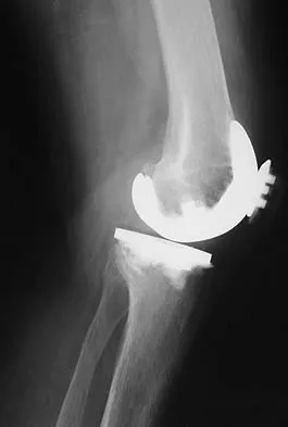 Anatomy 2005 Practice Questions: Set 3 (Solved) - Figure 5