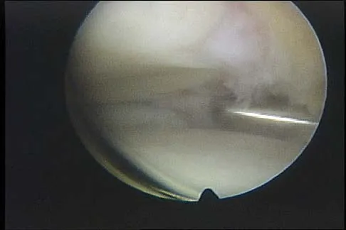 Anatomy 2005 Practice Questions: Set 3 (Solved) - Figure 8