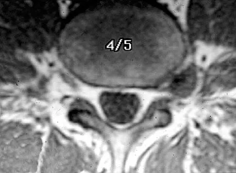 Anatomy Board Review 2005: High-Yield MCQs (Set 4) - Figure 15