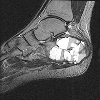 Anatomy Board Review 2005: High-Yield MCQs (Set 4) - Figure 19