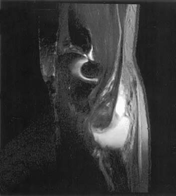 Anatomy Board Review 2005: High-Yield MCQs (Set 4) - Figure 25