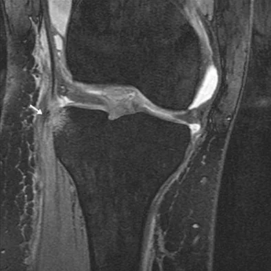 Anatomy 2008 Practice Questions: Set 1 (Solved) - Figure 14