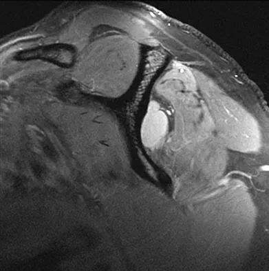 Anatomy 2008 Practice Questions: Set 1 (Solved) - Figure 21