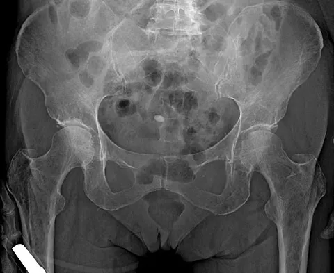 Anatomy 2008 Practice Questions: Set 1 (Solved) - Figure 22