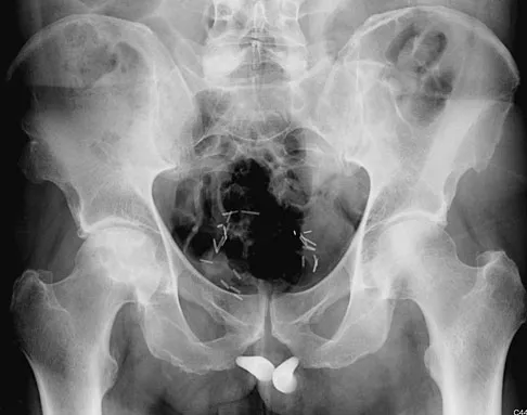 Anatomy 2008 Practice Questions: Set 1 (Solved) - Figure 23