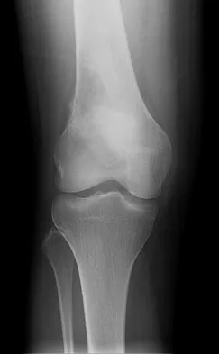 Anatomy 2008 Practice Questions: Set 1 (Solved) - Figure 26