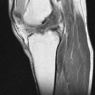 Anatomy 2008 Practice Questions: Set 1 (Solved) - Figure 30
