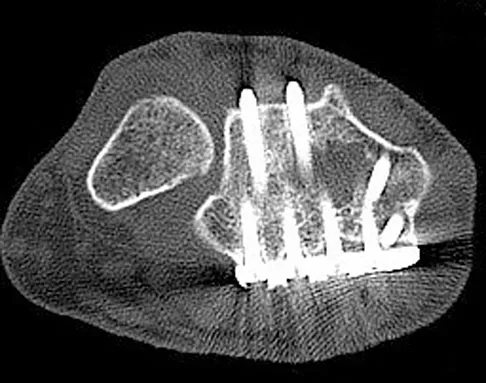 Anatomy 2008 Practice Questions: Set 1 (Solved) - Figure 34