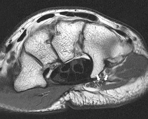 Anatomy 2008 Practice Questions: Set 1 (Solved) - Figure 35