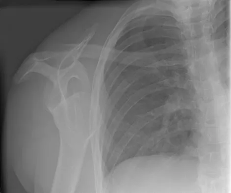 Anatomy 2008 Practice Questions: Set 1 (Solved) - Figure 6