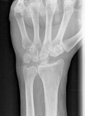 Anatomy Board Review 2008: High-Yield MCQs (Set 2) - Figure 10