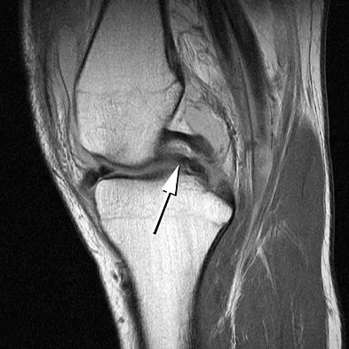 Anatomy Board Review 2008: High-Yield MCQs (Set 2) - Figure 15
