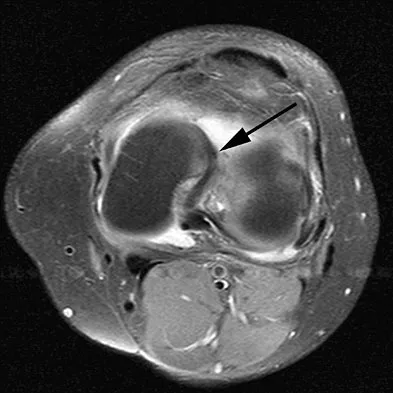 Anatomy Board Review 2008: High-Yield MCQs (Set 2) - Figure 16