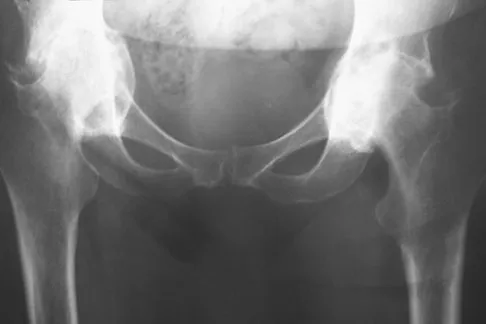 Anatomy Board Review 2008: High-Yield MCQs (Set 2) - Figure 17