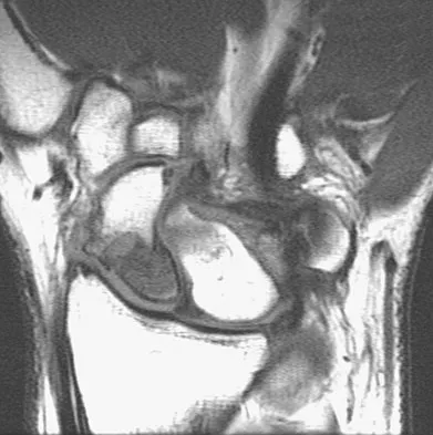 Anatomy Board Review 2008: High-Yield MCQs (Set 2) - Figure 19