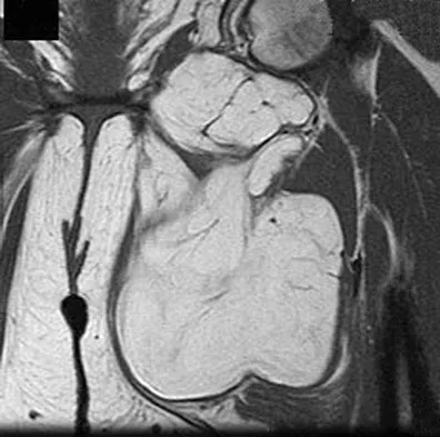 Anatomy Board Review 2008: High-Yield MCQs (Set 2) - Figure 20