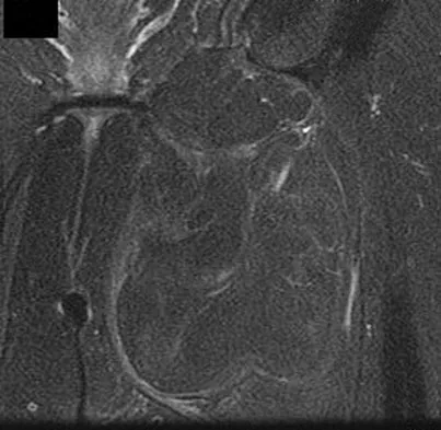 Anatomy Board Review 2008: High-Yield MCQs (Set 2) - Figure 21