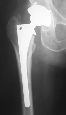 Anatomy Board Review 2008: High-Yield MCQs (Set 2) - Figure 24