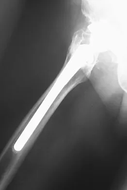 Anatomy Board Review 2008: High-Yield MCQs (Set 2) - Figure 27