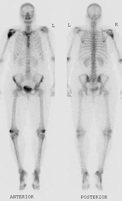 Anatomy Board Review 2008: High-Yield MCQs (Set 2) - Figure 31