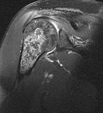 Anatomy Board Review 2008: High-Yield MCQs (Set 2) - Figure 34