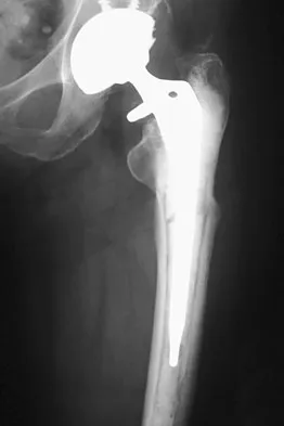 Anatomy Board Review 2008: High-Yield MCQs (Set 2) - Figure 36