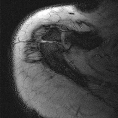 Anatomy Board Review 2008: High-Yield MCQs (Set 2) - Figure 37