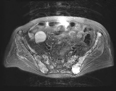 Anatomy Board Review 2008: High-Yield MCQs (Set 2) - Figure 7