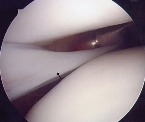 AAOS & ABOS Anatomy MCQs (Set 3): Skeletal, Joint, and Muscle Anatomy | Orthopedic Board Prep