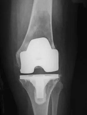 Anatomy 2008 Practice Questions: Set 3 (Solved) - Figure 16