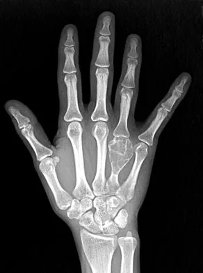 Anatomy 2008 Practice Questions: Set 3 (Solved) - Figure 4