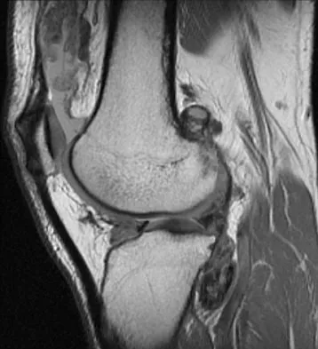 Anatomy Board Review 2008: High-Yield MCQs (Set 4) - Figure 11