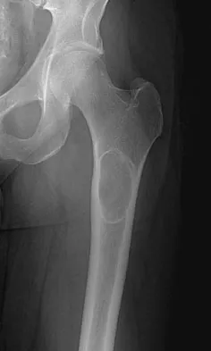 Anatomy Board Review 2008: High-Yield MCQs (Set 4) - Figure 19