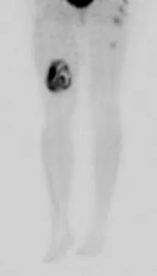 Anatomy Board Review 2008: High-Yield MCQs (Set 4) - Figure 4