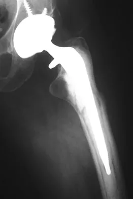 Anatomy Board Review 2008: High-Yield MCQs (Set 4) - Figure 6