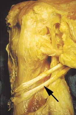 Anatomy 2026 MCQs: Board Review Questions & Answers (Part 1) - Figure 43