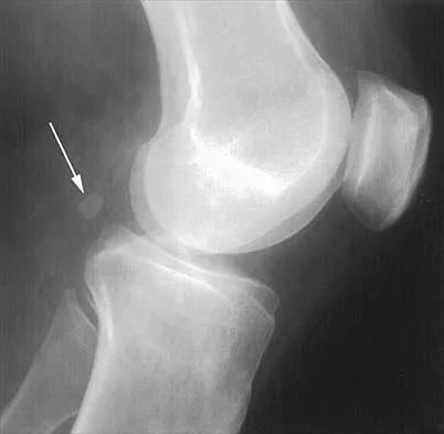 Anatomy 2026 MCQs: Board Review Questions & Answers (Part 2) - Figure 1