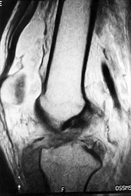Anatomy 2026 MCQs: Board Review Questions & Answers (Part 2) - Figure 101