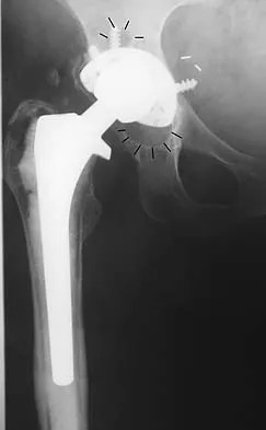 Anatomy 2026 MCQs: Board Review Questions & Answers (Part 2) - Figure 125