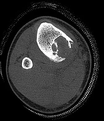 Anatomy 2026 MCQs: Board Review Questions & Answers (Part 2) - Figure 147
