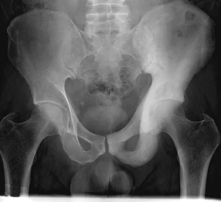 Anatomy 2026 MCQs: Board Review Questions & Answers (Part 2) - Figure 151