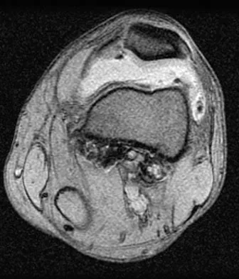 Anatomy 2026 MCQs: Board Review Questions & Answers (Part 2) - Figure 159