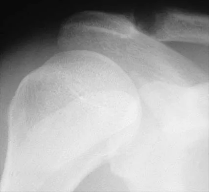 Anatomy 2026 MCQs: Board Review Questions & Answers (Part 2) - Figure 85