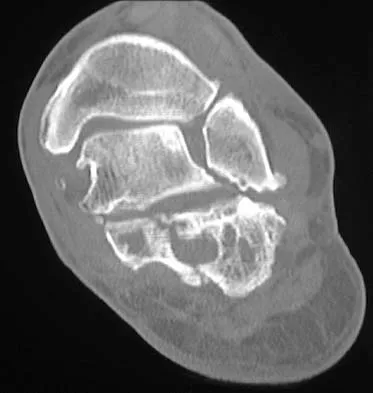 Anatomy 2026 MCQs: Board Review Questions & Answers (Part 3) - Figure 67